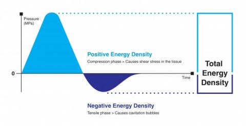 Radial_Shock_Wave_Therapy Characteristics